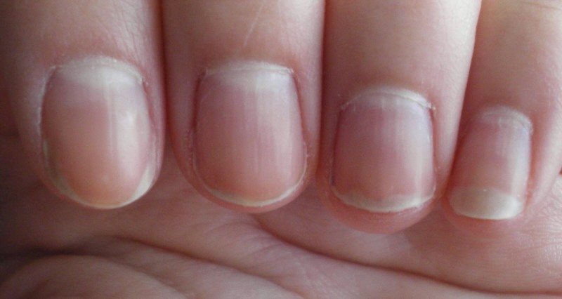 What Does Your Nails Say About Your Health?