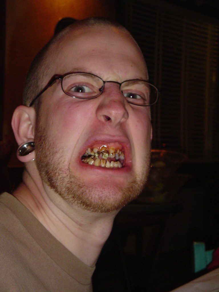 OH MAN THOSE LOOK LIKE THE STEREOTYPICAL BRITISH TEETH