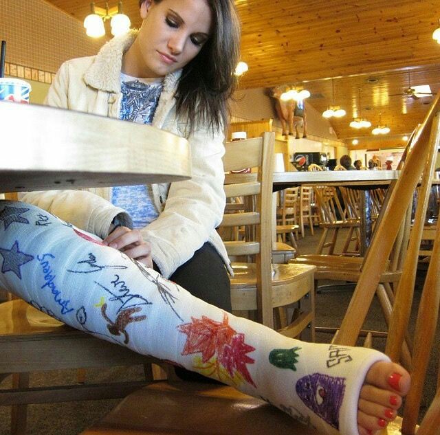 LLC Long Leg Cast kane Lynch Flickr