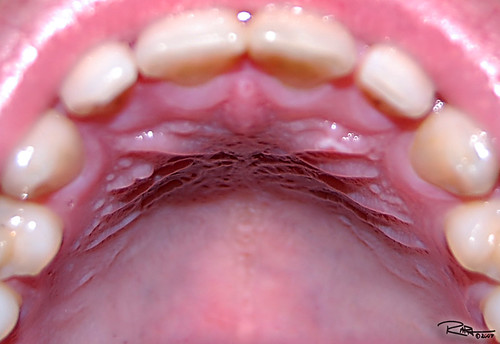 Roof of My Mouth as the title says... Raph Nogal Photography