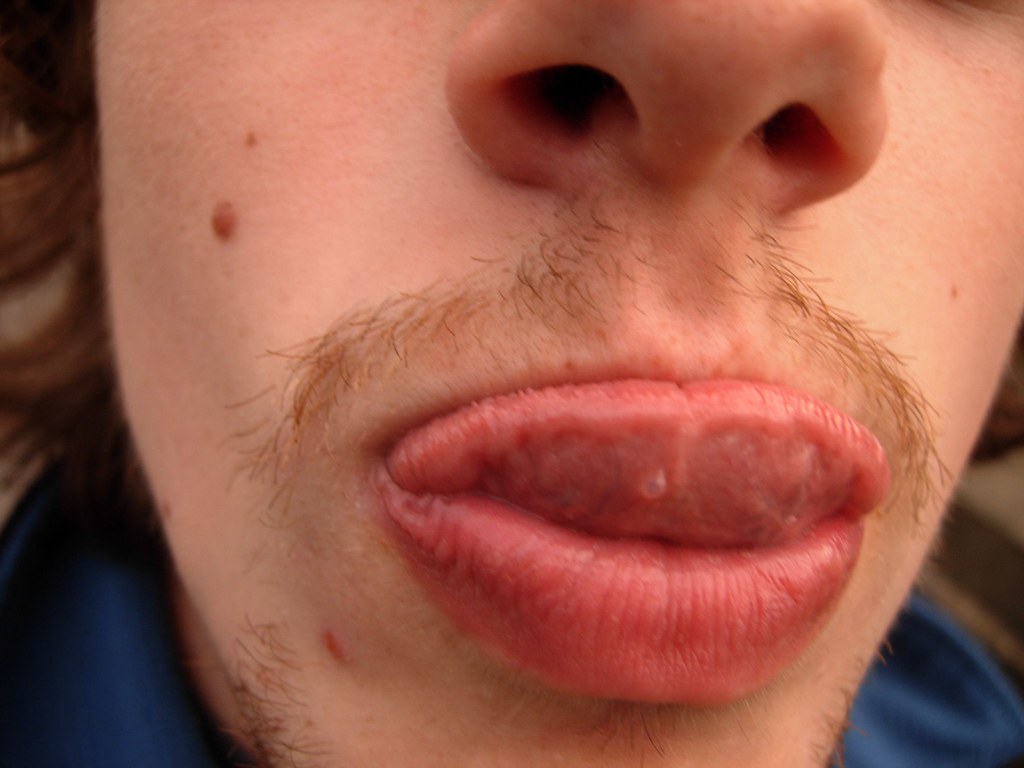 Random bubble thing on the bottom of my tongue Don't know … Flickr