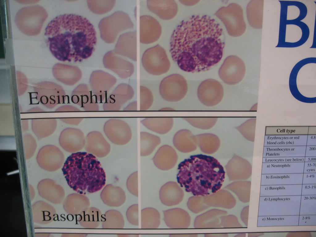 Eosinophils & Basophils Eosinophils & Basophils Flickr