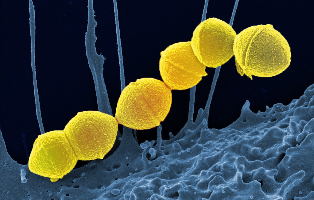 Group A strep Image of Group A streptococcus bacteria
