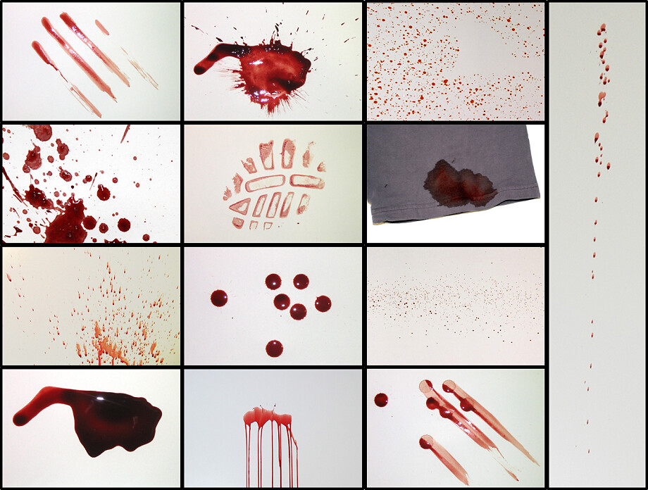 Bloodstain Pattern Analysis 101 Quiz By Pushcake