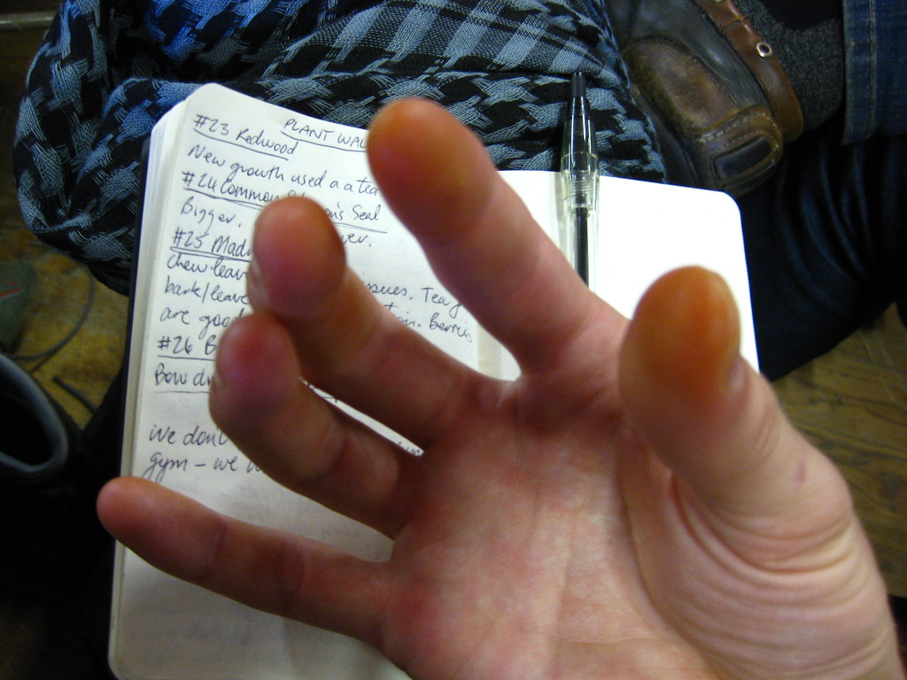 Burned Fingers Apparently I was handling my tinder bundle/… Flickr