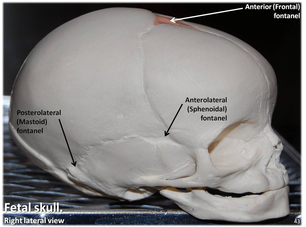 Fetal Skull, lateral view with labels Axial Skeleton Vis