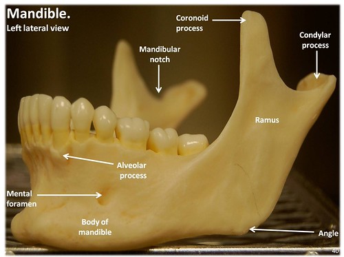 Mandible, lateral view with labels Axial Skeleton Visual