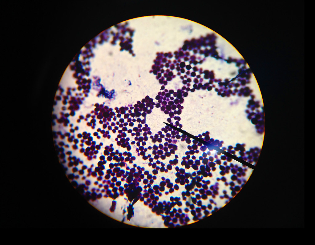 Staphylococcus aureus Gramstained S. aureus viewed under … Flickr