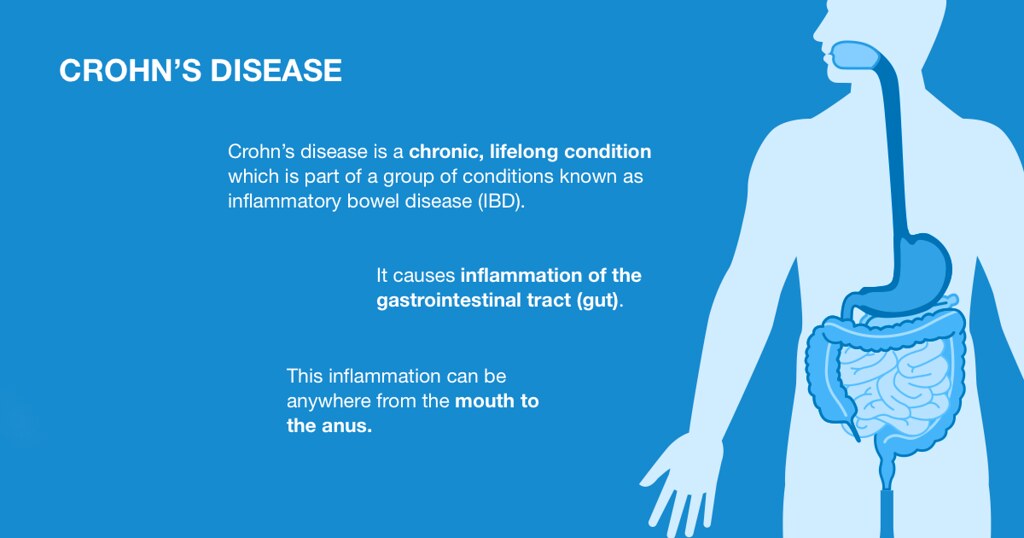 What is Crohn's disease? A graphic explaining what Crohn's… Flickr