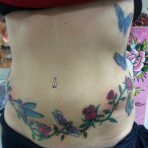 Tummy tuck scar cover up KustomKulture Flickr