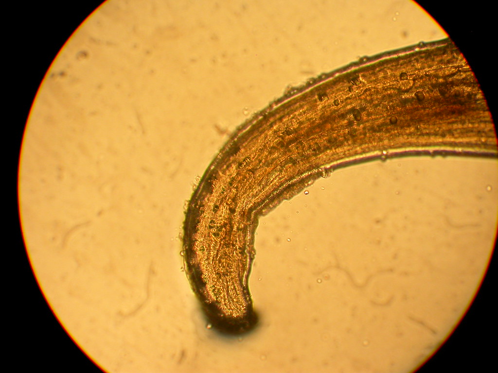 Loa Loa Tail End 2 Loa Loa filarial worm. This was extra… Flickr