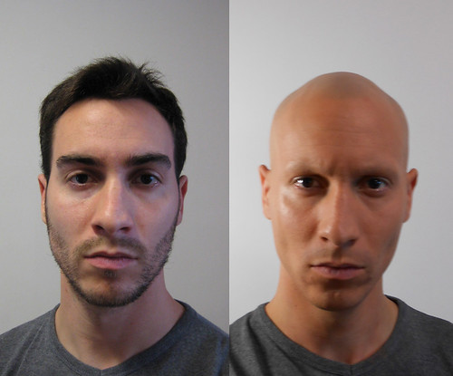 Does Kava cause hair loss? Kava