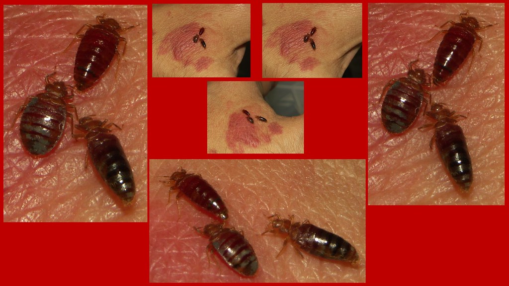 2+1 cimex 3 views of 3 bed bugs as they feed. There are 2 … Flickr