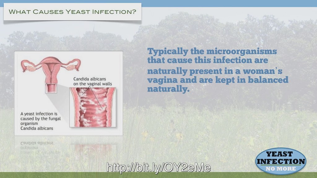 Untreated Yeast Infection Gain Complete Relief From Untr