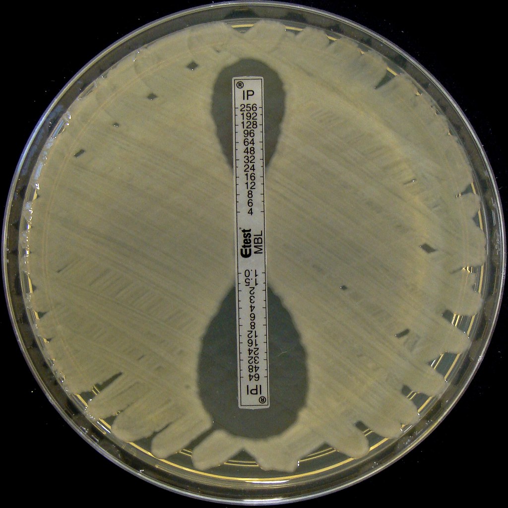E.coli NDM1 Metallo Betalactamase confirmation E.coli