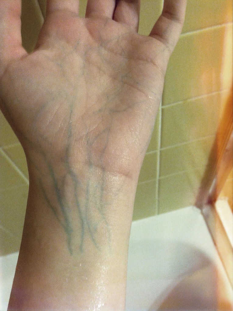 Hand Veins Very Blue at Alexandria Washington blog