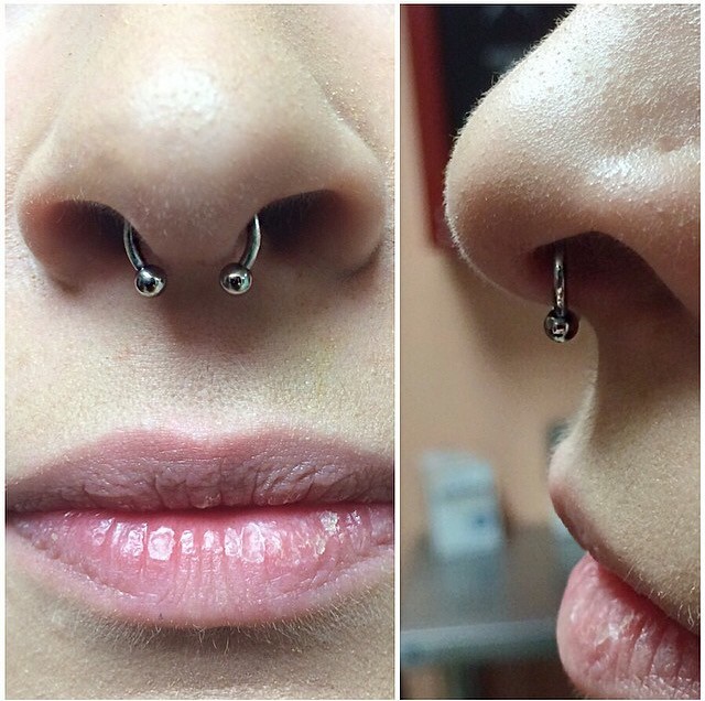 Septum Piercing Moved to the Side Should I fixed it? piercing