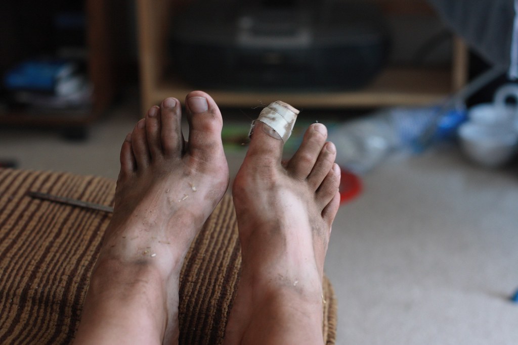 Sexy feet I would just like to record this moment of gross… Flickr