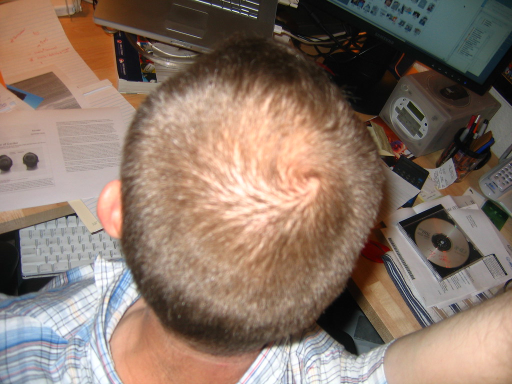 IMG_3464.JPG My clockwise whorl. About 8 of men have a co… Flickr