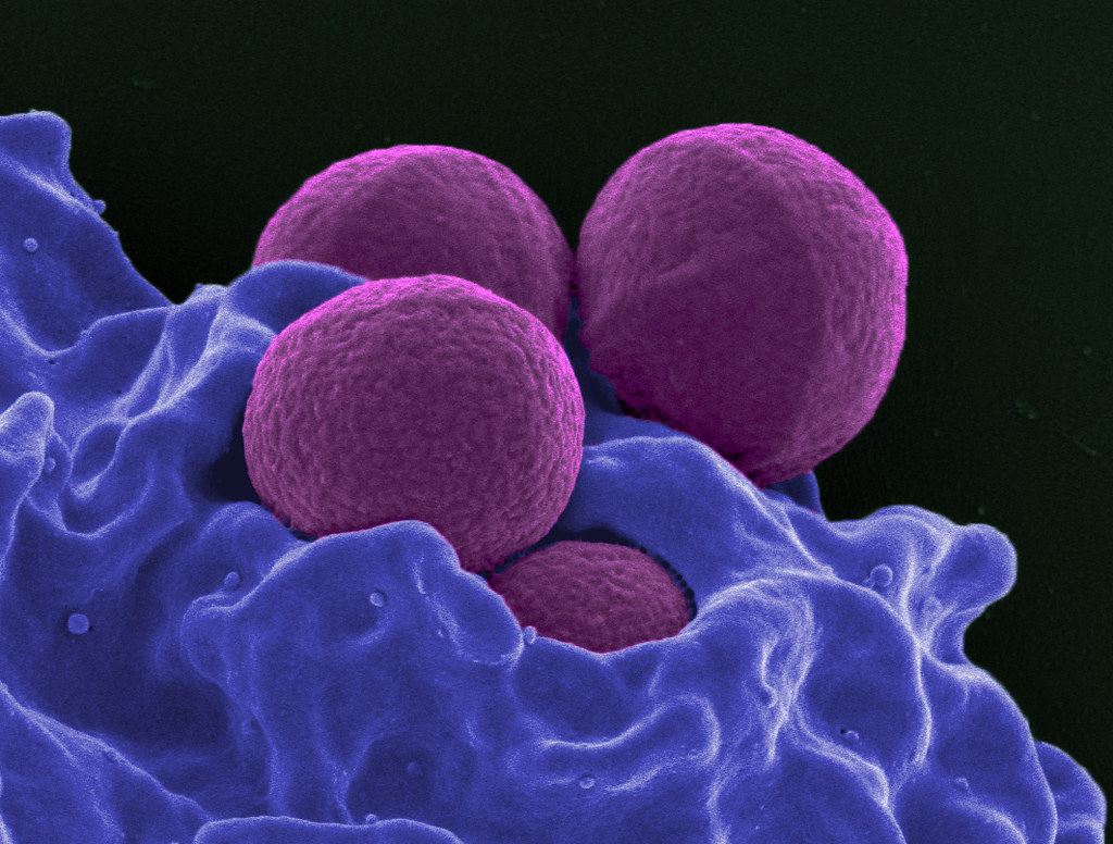 MethicillinResistant Staphylococcus aureus (MRSA) Flickr