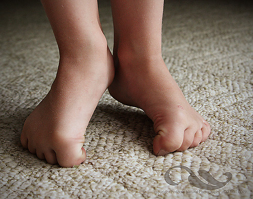 Ballerina Toes M When asked to stand on her toes, this is … Flickr