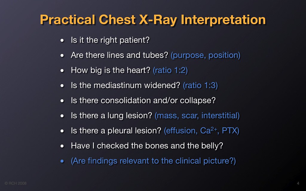 Practical clinical chest xray interpretation checklist Flickr