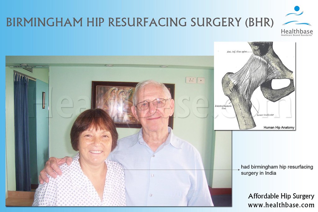 Birmingham Hip Resurfacing Surgery For affordable hip resu… Flickr