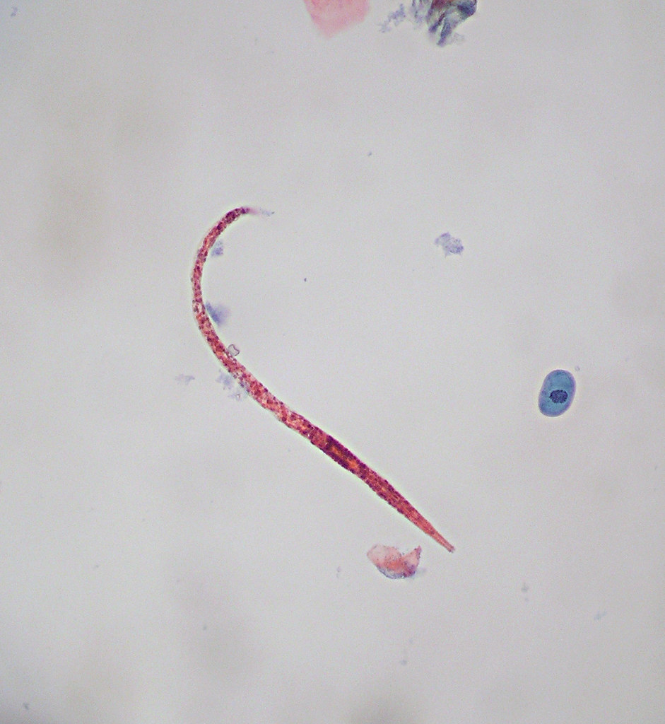 Worm in weewee Urine specimen with a worm. Hookworm, mayb… Flickr