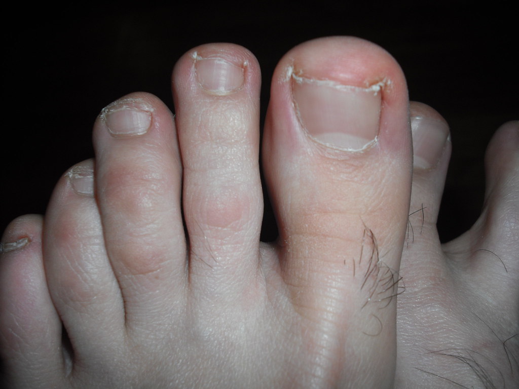 hairy legs and feet hairy feet and toes closeup Joey Johnny Flickr