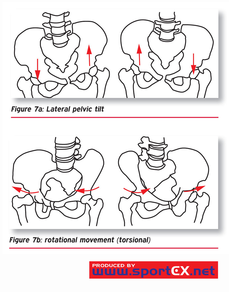 Lateral pelvic tilt and rotational movement (torsional) (1… Flickr