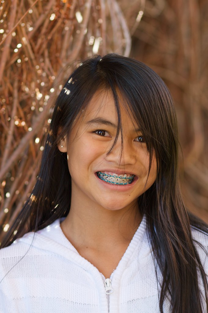 Mouth full of braces in the wicker scupltures at Colorado … jarring
