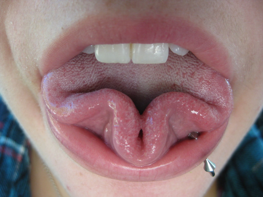 3 leaf clover my tounge & 2 buck teeth ] maggie acuna Flickr