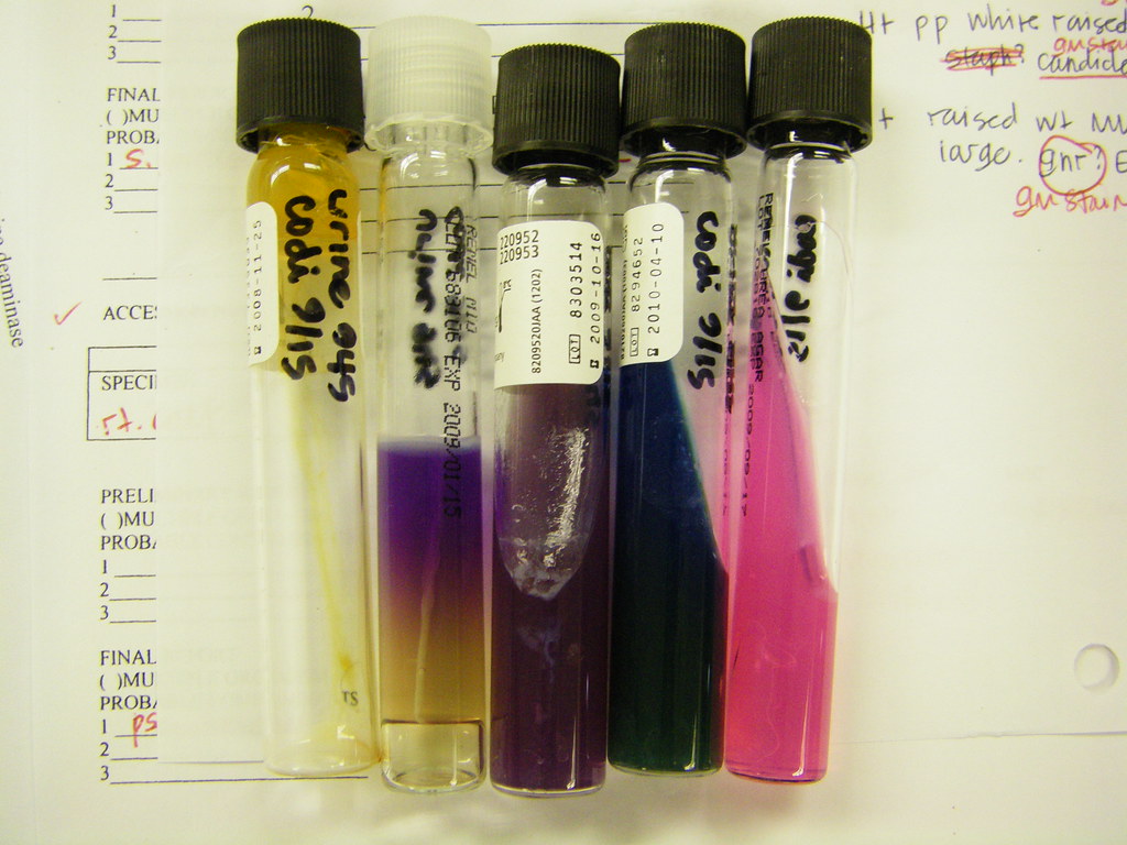 Urine Culture 1 (Biochemical tests) 48hr incubation Flickr