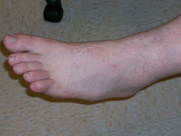 See the lump on the side of his foot That s bone Tamara Flickr