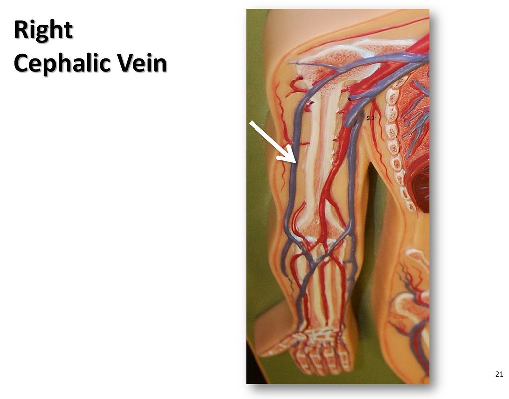 Right cephalic vein The Anatomy of the Veins Visual Guid