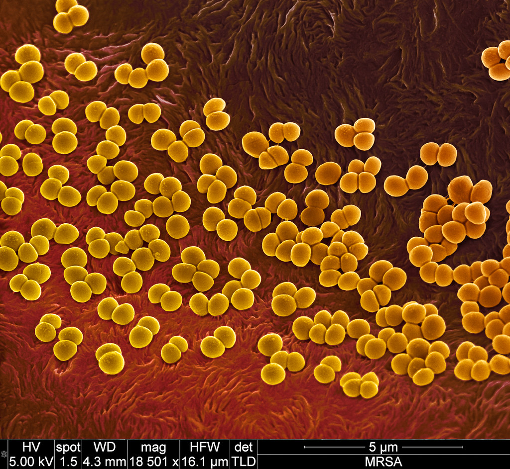 MRSA antibiotic resistant bacteria Methicillin Resistant S… Flickr