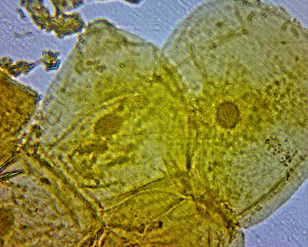 CheekCell_400x Human cheek cells stained with iodine at 40… Flickr