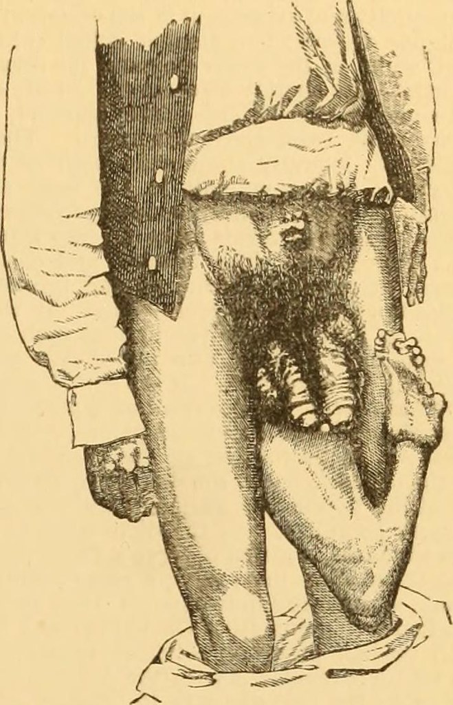 Image from page 32 of "A Reference handbook of the medical