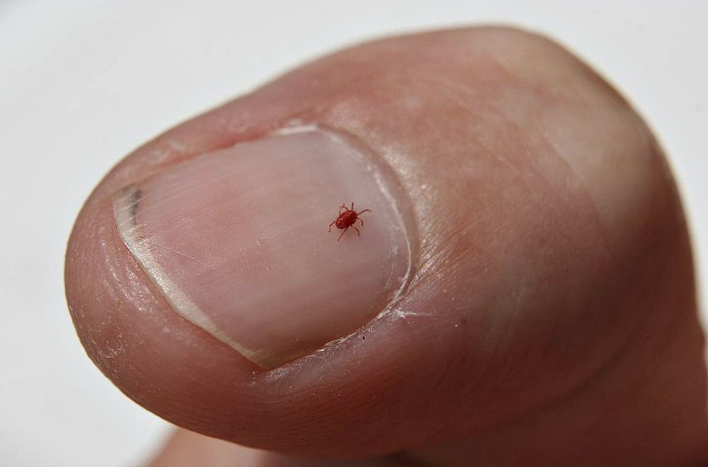 Eight Legged Bugs Do you feel sometimes that you have bugs… Flickr