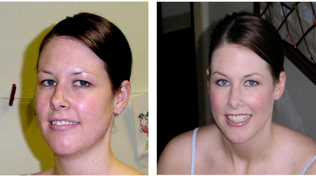 Alcone's Limelight (LimeLife) Review Limelight Skin Care