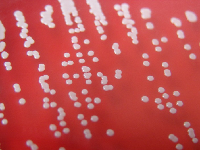 CNS01 Coagulase negative Staphylococcus on 5 blood agar. … Flickr