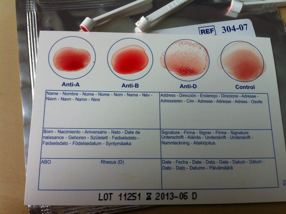 2012.05.04 Eldoncard Blood Type Test