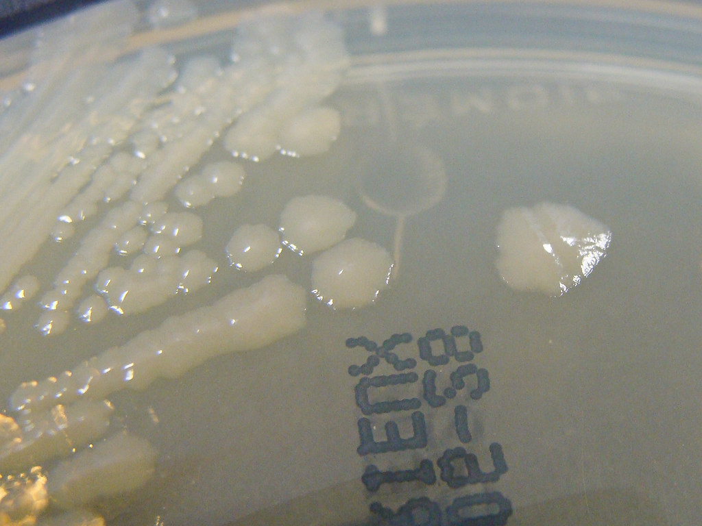 Salmonella enteritidis on ChromID CPS Agar Detail Flickr