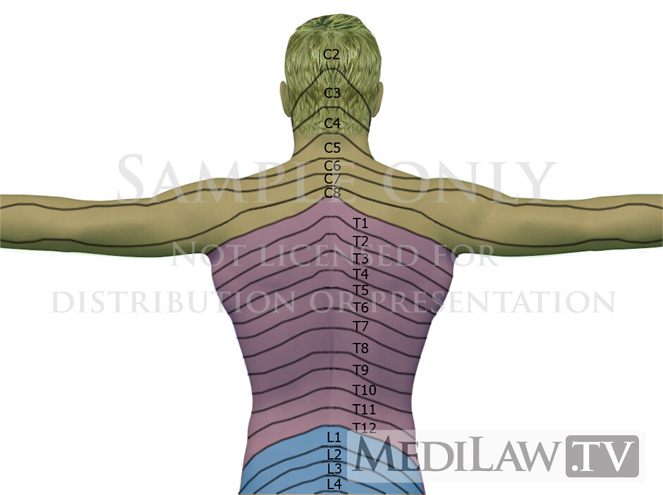 rheumatology images CervicalDermatomeAnatomy04