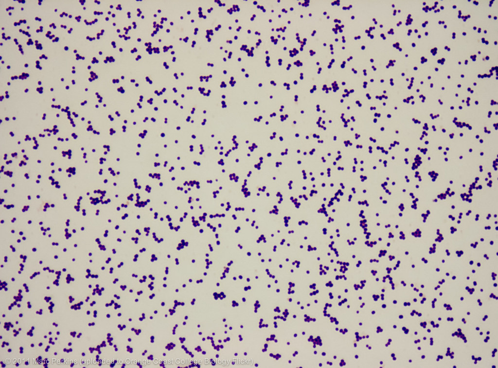 Staphylococcus epidermidis 1,000x 2 A slide of gramstaine… Flickr