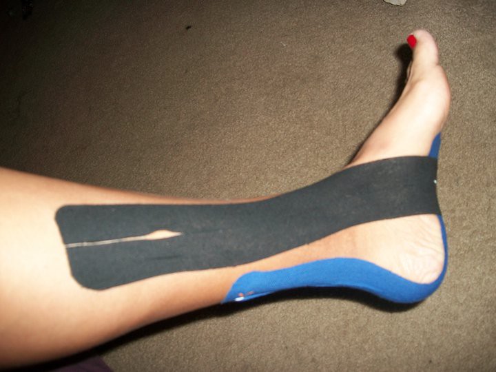 KT Tape for Plantar Fasciitis at the PF Chang's Rock n Rol… Flickr