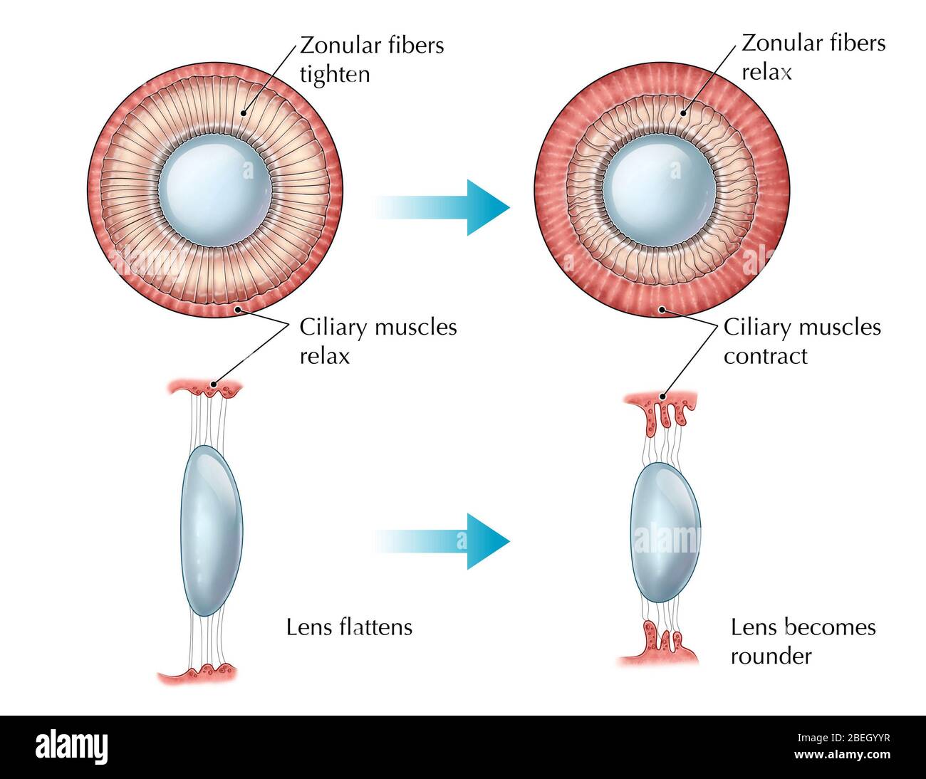 Suspensory Ligaments Of The Eye