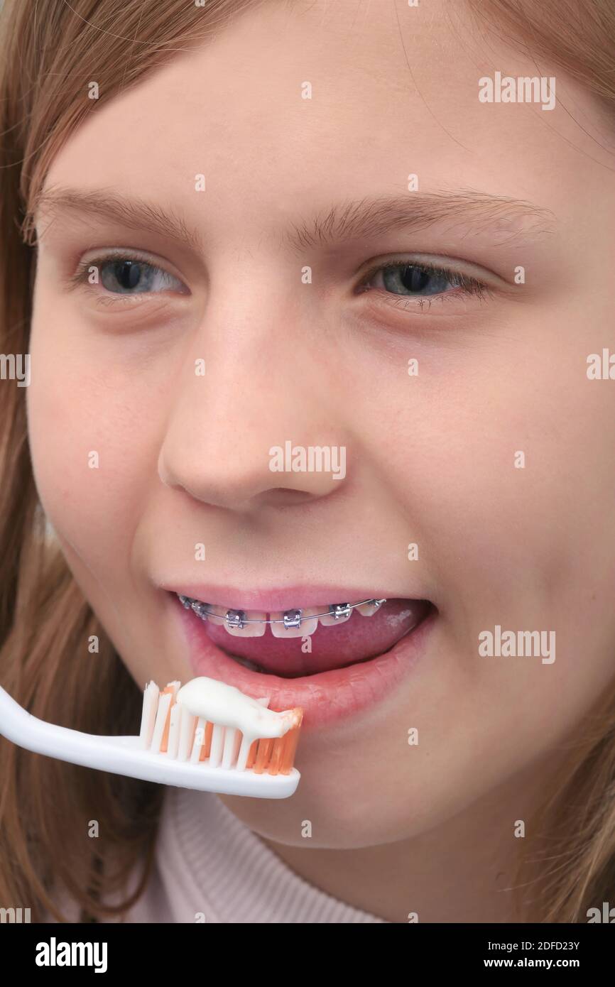 Young girl with braces hires stock photography and images Alamy