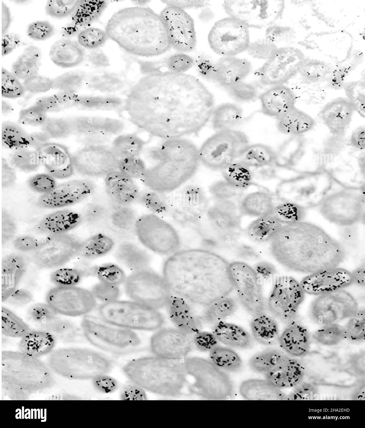 Chlamydiae hires stock photography and images Alamy