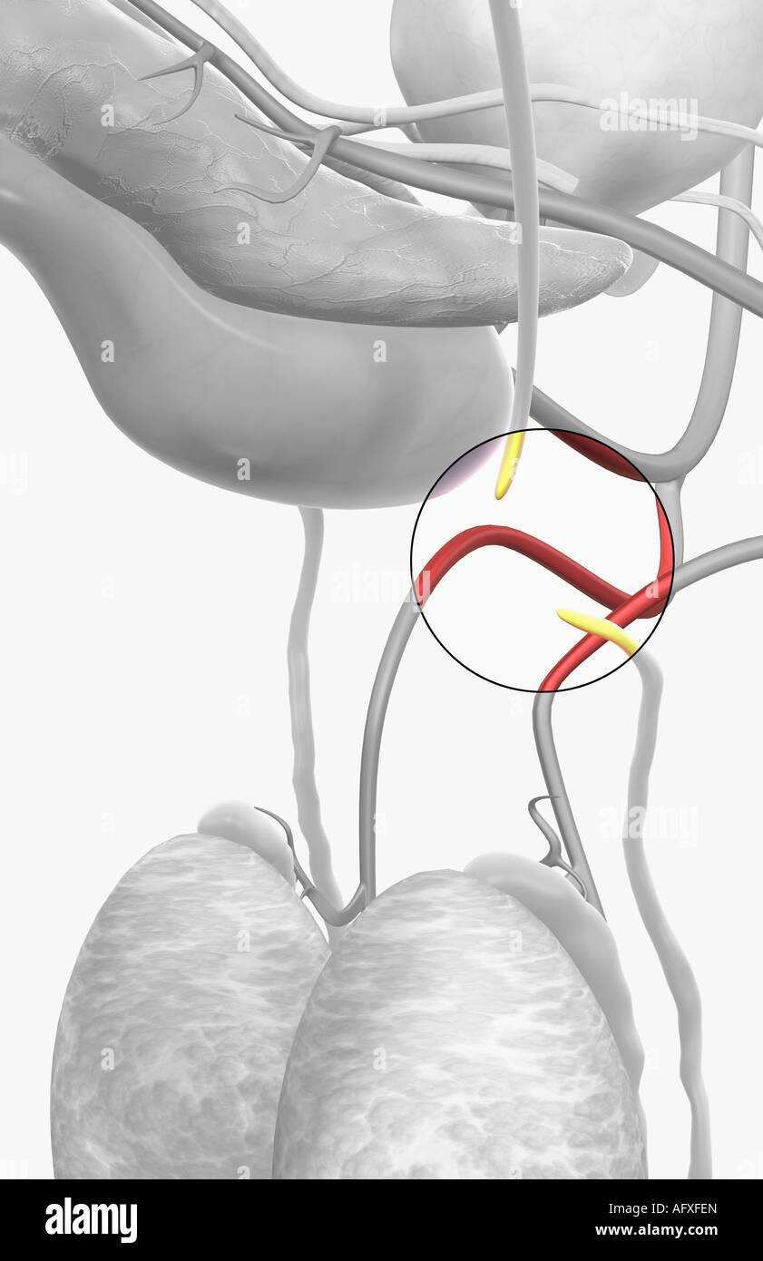 Vasectomy hi-res stock photography and images - Alamy